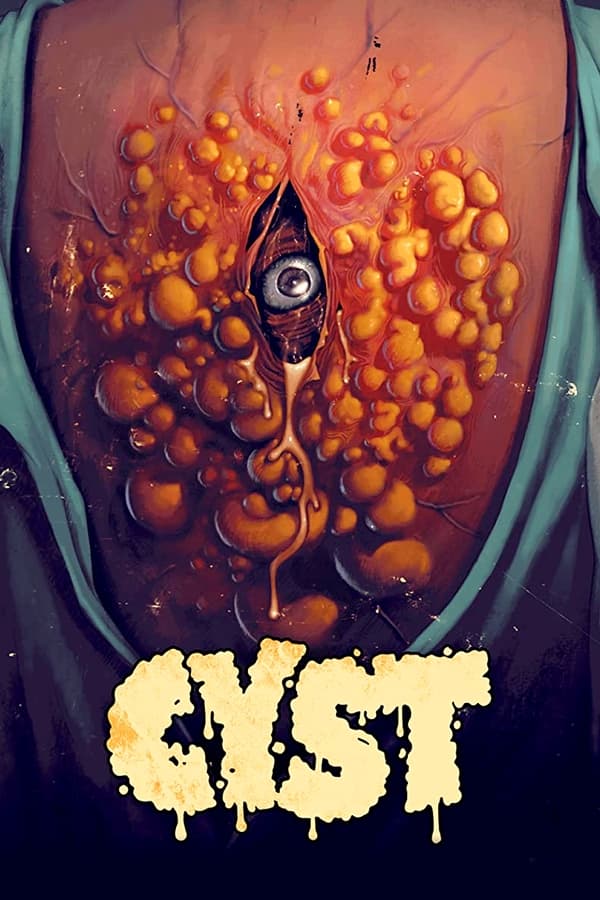 فيلم كيس Cyst 2020 مترجم اون لاين
